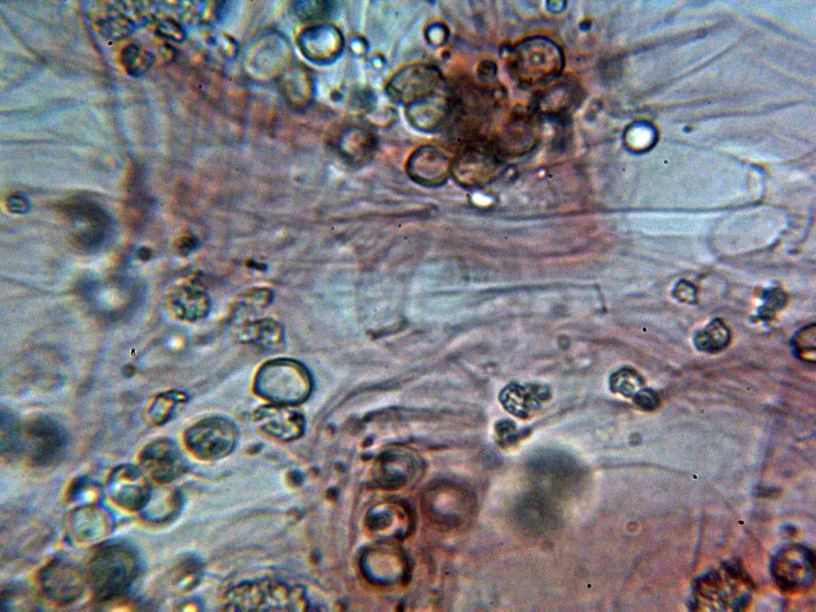 Microscopía de Pluteus plautus - 10 - Suprapellis 3